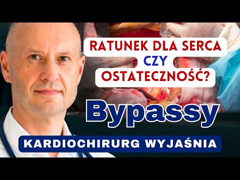 Wykonałem SETKI Bajpasów  - Jaki są NAJCZĘSTSZE pytania? #serce #bajpasy #bypassy #CABG #operacja