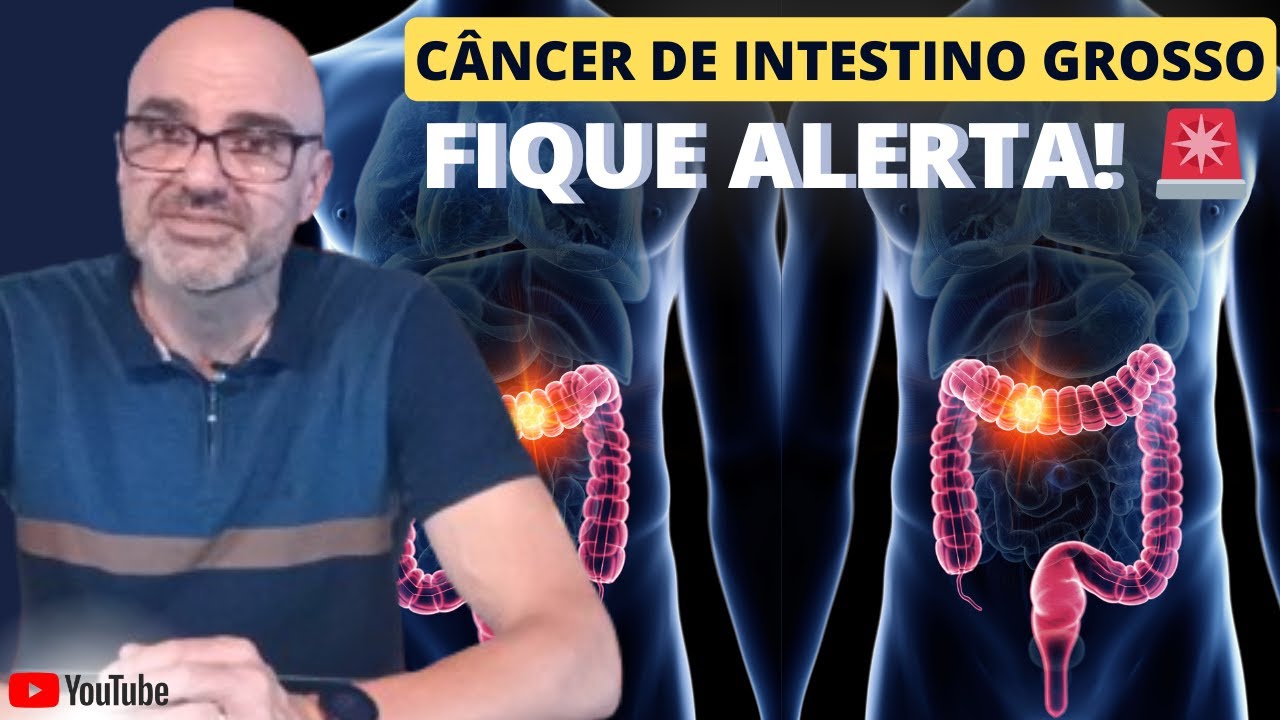Câncer de Intestino Grosso: Sinais de Alerta, Prevenção e Tratamento!