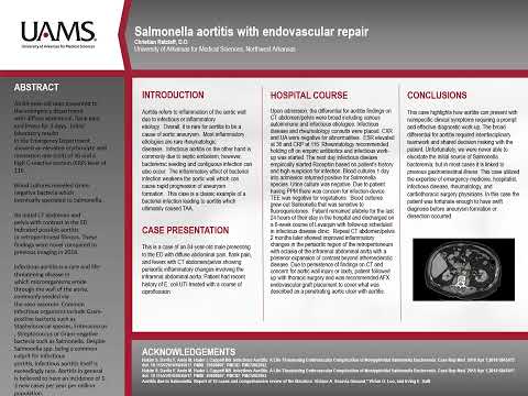 Salmonella infectious aortitis with endovascular repair