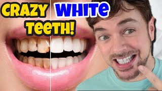 Get CRAZY WHITE Teeth! | Best Teeth Whitening Products That Work | Chris Gibson