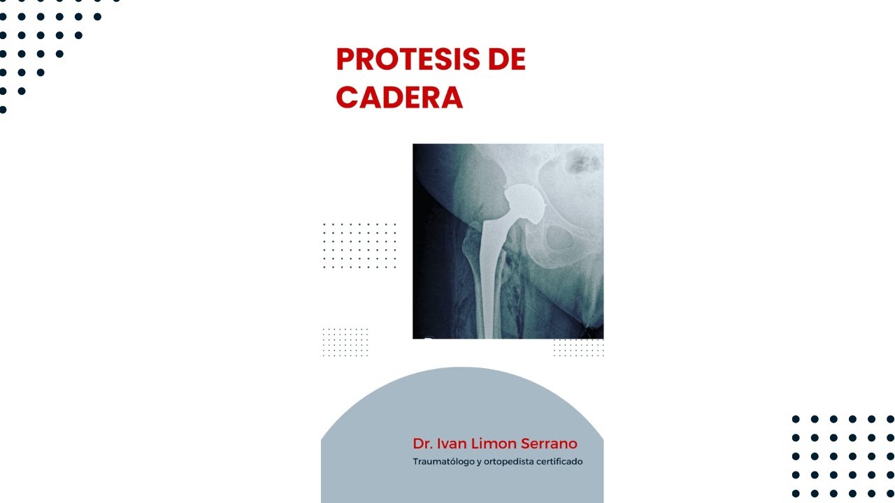 Iván Limón Serrano-53