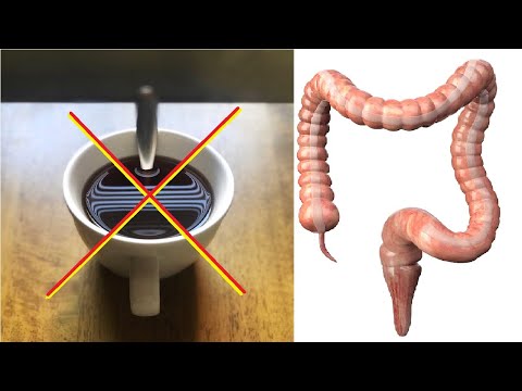 UVIN CAJ JE OPASAN u ovim situacijama