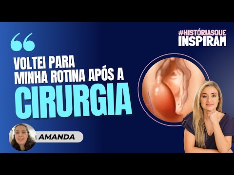 Thumbnail do vídeo