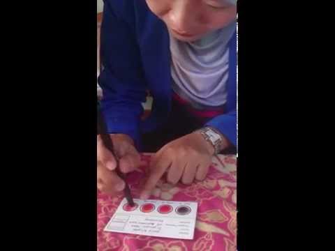 Sebelum dan sesudah penurunan berat badan Kovalkov Cara menghilangkan lemak dari latihan kaki