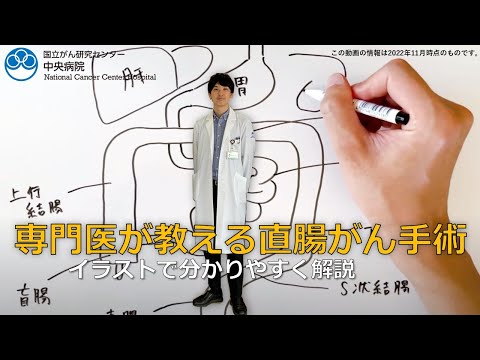 科学者たちはバイアグラが結腸がんと戦うのに役立つ可能性があると疑っている