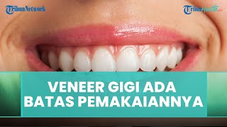 Veneer Gigi ada Batasan Usia Pemakaian Begini Jawaban dari drg Farra Nadiya