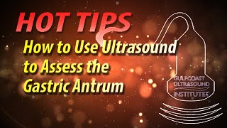 Hot Tip How to Use Ultrasound to Assess the Gastric Antrum GUARD Protocol