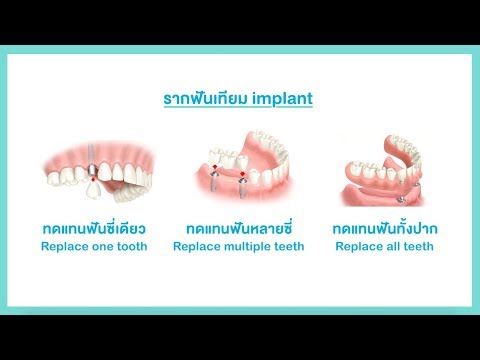 วิธีการที่จะยกหน้าอกหย่อนคล้อยโดยไม่ต้องผ่าตัด เพิ่ม myostimulator เต้านม
