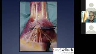 GP Webinar - Welbeck Orthopaedics Hand & Wrist Team - 22nd July 2020
