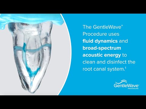 Demonstrating the GentleWave® Technology