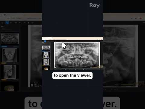 SMARTDent : 5D Tutorial #1-7. Export Patient Data with Viewer to CD, DVD, or Folder
