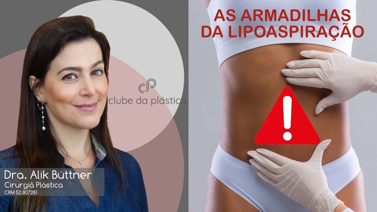As armadilhas da lipoaspiração
