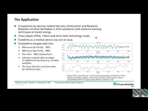 Design of an Artificial Neural Network Circuit for Detecting Atrial Fibrillation in ECG Signals