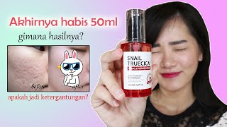 Download lagu REVIEW SOME BY MI SNAIL TRUECICA MIRACLE REPAIR SERUM SETELAH HABIS SATU BOTOL mp3