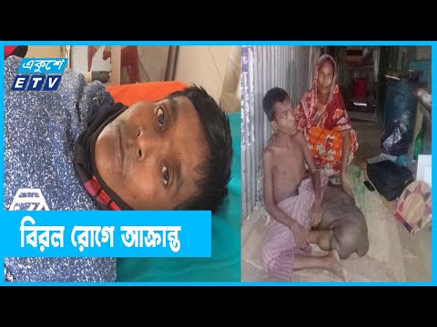 বিরল রোগে আক্রান্ত হৃতদরিদ্র রফিকুল