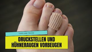 So kannst du schmerzhaften DRUCKSTELLEN und HÜHNERAUGEN vorbeugen!
