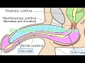 urethral stricture