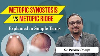 What is the difference between Metopic Synostosis and Metopic Ridge - Dr. Vybhav Deraje