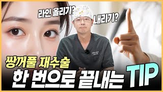 눈재수술 할거면 이 영상 한 번만 보고 가세요