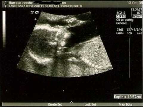 skymtar för en stund film_0003.wmv