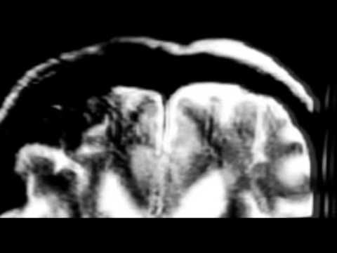 Codigo Sur - Solo queda [C- Sur Record's]