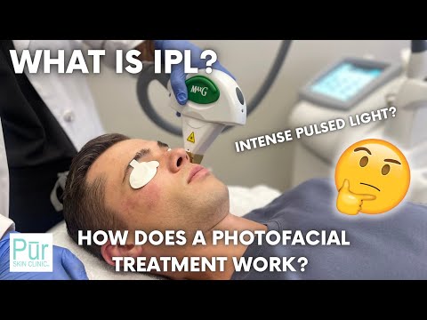 What is IPL? | How Does an IPL Intense Pulsed Light...