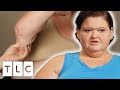 Amy Wants To Get Excess Skin Removal Surgery | 1000lb Sisters