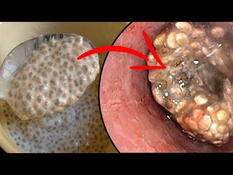 Salawal para sa slimming turbo Ang ilang mga mani ay tumutulong sa mawala timbang