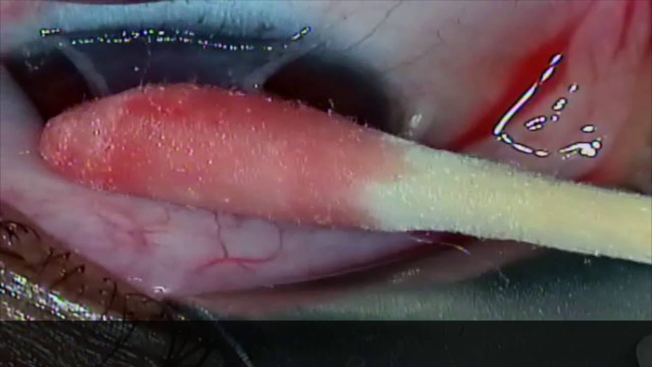 Mauricio Velez Fernandez-21