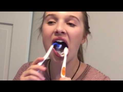 Patient demonstrating Mouth-Mate after having Wisdom...