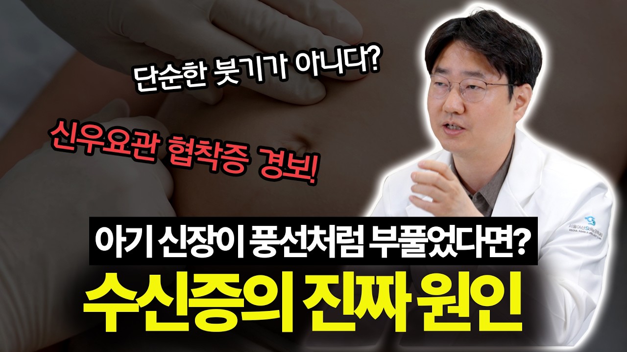 우리 아이 배에서 멍울이 만져진다면? 신우요관이행부 폐색증 로봇 수술 치…