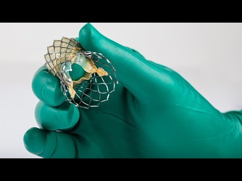 TAVI—Evolution in Landscape