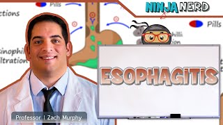 Esophagitis | Clinical Medicine