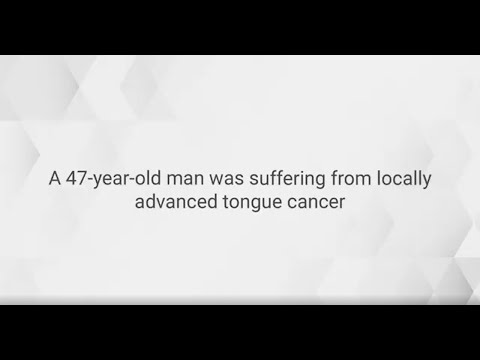 Conquering Tongue Cancer: A Patient's Inspiring Journey