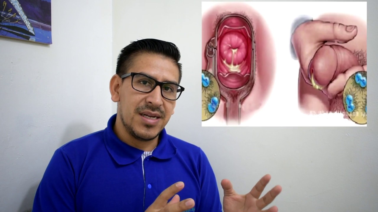 Watch SÍFILIS, GONORREA y CLAMIDIA LAS ITS MAS COMUNES Now SÍFILIS, GONORREA y CLAMIDIA LAS ITS MAS COMUNES