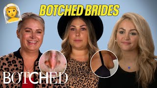 Botched Brides: Pulverized Noses, Extra Breasts and More! (Before & After) | Botched | E!