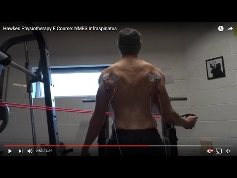 Hawkes Physiotherapy E Course: NMES Infraspinatus