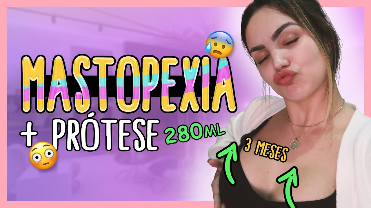 Watch Now 3 MESES DA MINHA CIRURGIA || Suzanna Freitas 3 MESES DA MINHA CIRURGIA || Suzanna Freitas