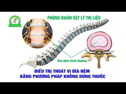 TRỊ LIỆU THOÁT VỊ ĐĨA ĐỆM
