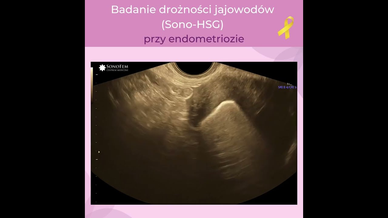 Kamil Sobociński-10