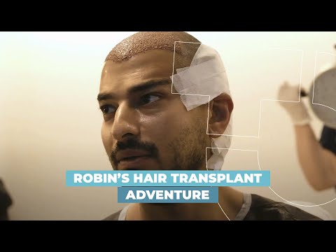 L'aventure de la greffe de cheveux de Robin