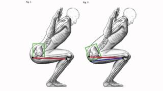 douleurs au genou - Les 8 causes les plus fréquentes de vos douleurs aux genoux