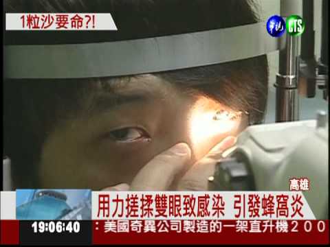 沙進眼猛搓揉 引發蜂窩炎險送命