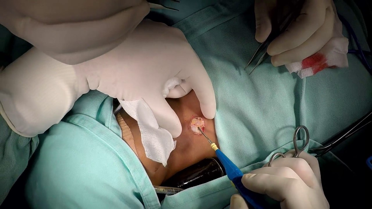 Yorgel Reyes Alvarez-4