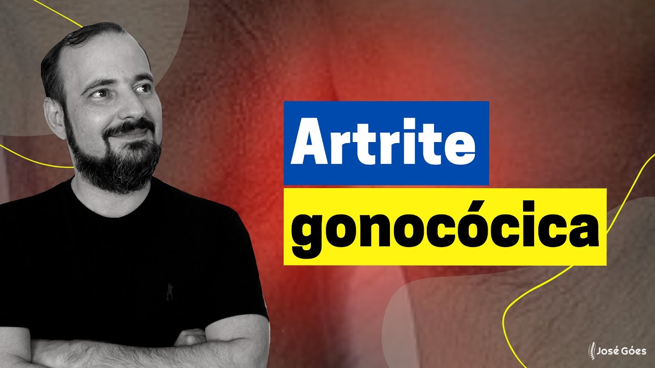Artrite gonocócica | José Góes