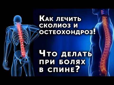 Лечение грудного кифоза у взрослых Врожденный сколиоз поясничного отдела позвоночника