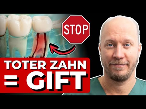 TOTER ZAHN: Warum niemand über DIESES Gift redet