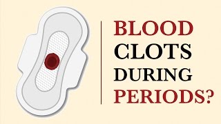 What Causes Blood Clots During Periods (Menstruation)? | Her Body