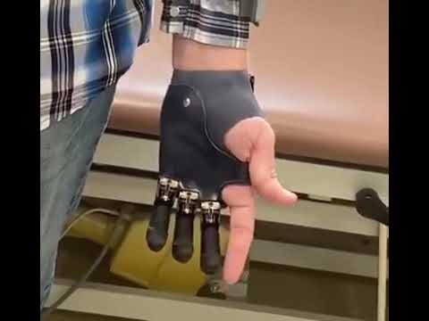 Bionic Hand Prosthesis