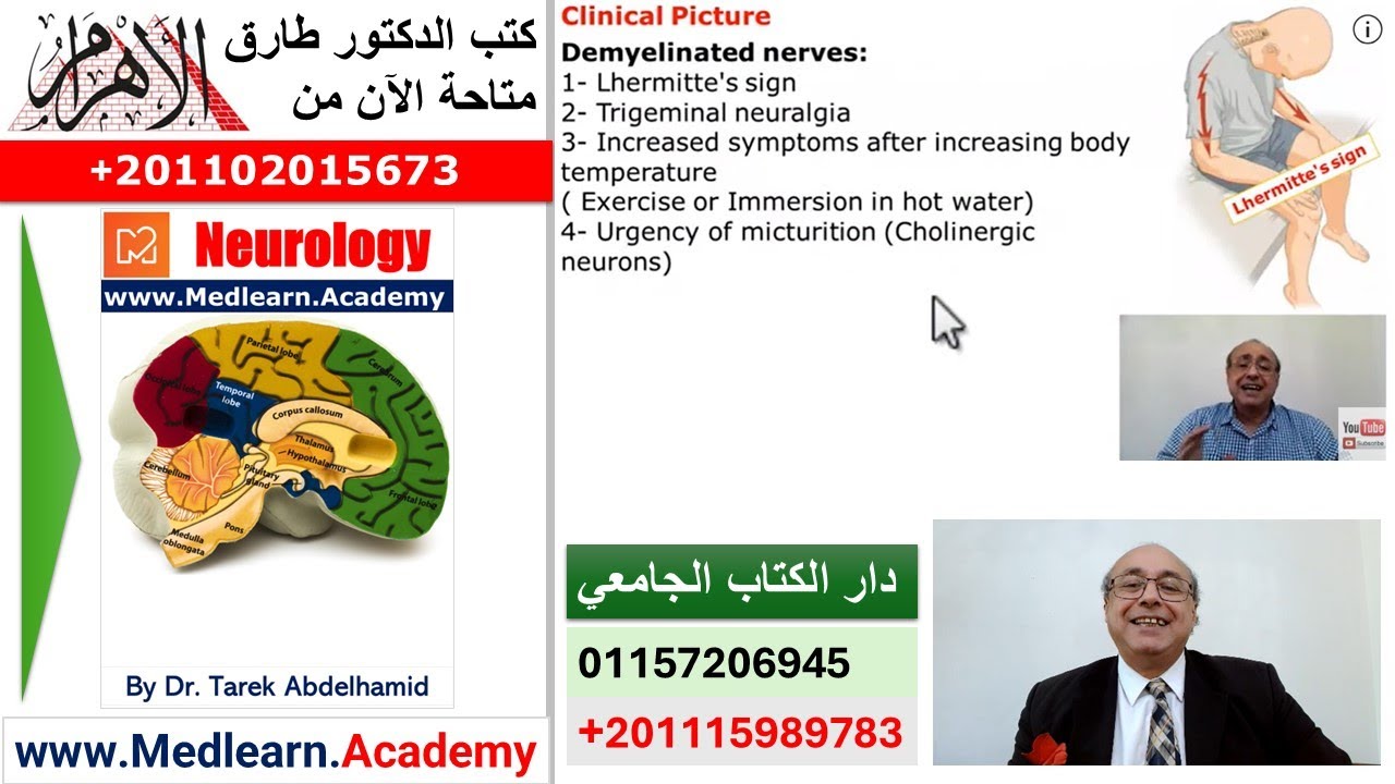 Multiple Sclerosis (MS) #internal_medicine #cme #medicaleducation #محاضرات_باطنة #medicalcollege
